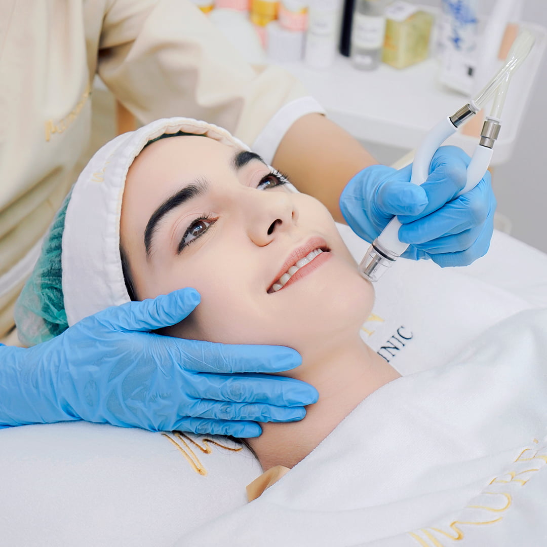 gambar treatment silkpeel di Mureeskin Clinic untuk artikel masalah wajah ini tanda kamu harus segera treatment silkpeel