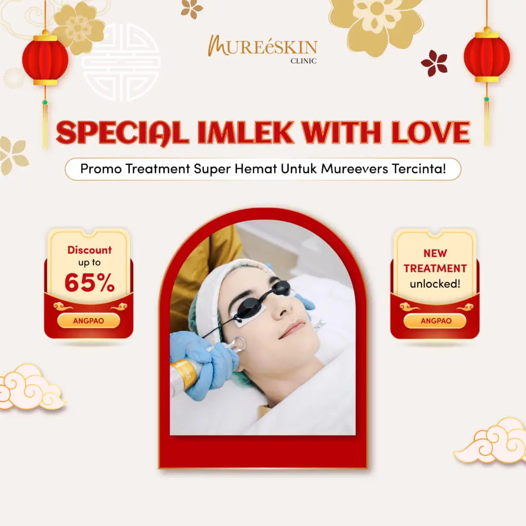 foto flyer untuk artikel pilih promo treatment februari